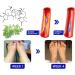 Gfouk Numbfix Hands and Foots Spray for Discomfort Caused by Joints Numbfix Hands and Foots Spray for Applies to Everyone Relieves Various Joint Pains (1pcs) - Buy Online on GoSupps.com