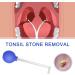 Tonsil Stone Remover Tool - Effective Almond Stones Caster Glass for Oral Hygiene | Mandelsaugers Tonsillenstein Remover for Mouth Cleaning - Buy Online on GoSupps.com