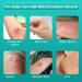Dimora Hydrocolloid Wound Dressing 10 Pack - Ultra Thin 4 x 4 Large Patch Bandages - Fast Healing for Bedsore, Burn, Blister, Acne Care - Sterile and Waterproof - Pack of 10 - Buy Online on GoSupps.com