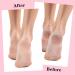 Yolev 2 Pairs Silicone Moisturizing Foot Socks Soft Silicone Socks Anti Slip Gel Spa Socks Women Foot Care Spa Pedicure Silicone Socks for Cracked Heel and Softening Rough Skin Calluses - Buy Online on GoSupps.com