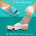 Orthopedic Bunion Corrector for Women & Men - Adjustable Toe Straightener with Silicone Pad and Heel Strap - Buy Online on GoSupps.com