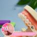 Buy XKSOC Orthodontic Wax for Braces - 5 Pieces 25 Strips Assorted Colors & Flavors | Pain Relief & Comfort - Buy Online on GoSupps.com