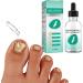 Nail Fungus Removal Liquid - Natural Toenail Fungus Oil for Effective Nail Care | BTSEURY - Buy Online on GoSupps.com