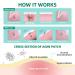 Acotye Pimple Patches 210PCS with Tea Tree Oil, Salicylic Acid & Niacinamide - Blemish Spot Relief - Invisible Patch in 4 Sizes - 8mm, 10mm, 12mm, 14mm - Buy Online on GoSupps.com