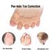 Buy Bunion Corrector & Relief Sleeve - Gel Pads for Men & Women | Fix Hallux Valgus & Restore Toe Shape - Buy Online on GoSupps.com