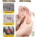 2023 Beautwar Clear Silicone Toe Protectors - Anti-Friction & Breathable Caps for Corns & Blisters (10PCS) - Buy Online on GoSupps.com