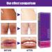 Lip Lightening for Dark Lips Reduces Lip Spots Cracking and Dryness Japanese Saura Extract Suitable for Smokers and Non-Smokers (1 pcs Smoker Lips Treatment Dark Lips) - Buy Online on GoSupps.com