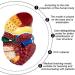 Teaching Model Human Liver Model with Base and Clear Texture and Pathological Features Liver Pathology Teaching Model for Teaching Models Doctor-Patient Communication - Buy Online on GoSupps.com