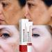 2Pcs Dark Spot Remover Set - Collagen & Vitamin A Cream for Face, Body, Intimate & Sensitive Areas - Powerful Dark Spot Corrector & Age Spot Remover - Buy Online on GoSupps.com