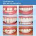 Temporary Dental Repair Beads - Fast Denture Fix for Missing & Broken Teeth Degradable Tooth Filling Material (30g) - Buy Online on GoSupps.com