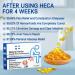 Inalsion Heca Natural Herbal Hemorrhoid Relief Capsules - 2 Boxes - Buy Online on GoSupps.com