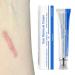 mother Scar ointment after op scar ointment for old scars versatile scar cream for surgical scars caesarean section acne scars burns keloids 30 g