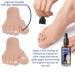German ToenailPlus Anti Paronychia Relief Oil - Repair Damaged Nails (2 Pcs) - Buy Online on GoSupps.com