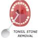 Tonsil Stone Removal Tool - Manual Style Cleaner for Adults | Oral Care Mouth Cleaning - Buy Online on GoSupps.com