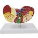 Liver Damage ical Model Liver Pathology Models Teaching Aids - 22.5 * 17 * 16CM