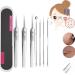 Usiveinborn Blackhead Remover Usiveinborn Tweezers Teppeic Tweezers Usiveinbor Pimple Popper Tool Kit Stainless Steel Professional Facial Blackhead Remover Tweezers 125 Elbow Design (7PCS)