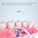 Cordless Water Flosser - Professional Electric Dental Oral Irrigator | 220ML Waterproof 3 Modes - Portable Teeth Cleaner for Home Use - Buy Online on GoSupps.com
