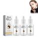 Irisink Eye Drops Irisink Color Changing Eye Drops Irisink Pro Eye Drops Change Eye Color Lighten and Brighten Your Eye Color (3Pcs A-Honey) 3Pcs A-honey