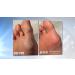 Rechargeable Personal Pedi Foot Callus Remover by Laurant - Smooth, Soft Feet Guaranteed - Buy Online on GoSupps.com