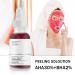 Peeling Solution 30ML | AHA 30% + BHA 2% Anti Acne Serum | Exfoliating Facial Serum for Pore Congestion & Fine Lines | 1 PCS - Buy Online on GoSupps.com