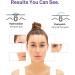 Large Acne Pimple Patches with Tea Tree Oil & Salicylic Acid - XL Zit Patches for Face Chin & Back | Fast Shipping Worldwide - Buy Online on GoSupps.com