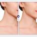 Cryfokt Neck Lift Tape Tightening Skin Color Eliminating Wrinkles Facial Neck Lift Tape For Stage Shows - Buy Online on GoSupps.com