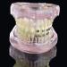 LBYLYH Orthodontic Demonstration Model - Teeth Teaching Tools with Metal & Ceramic Support for Effective Dental Treatment - Buy Online on GoSupps.com