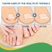 200pcs Ingrown Toenail Corrector Strips - Fitmedify Nail Patches for Toe Nails Fungus - Relief for Ingrown Toenails - Buy Online on GoSupps.com