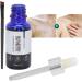Natudeco 20ml Vitiligo Concealer Liquid Waterproof Skin Concealer with Brush for Face and Body Coverage for Vitiligo and Other Skin Conditions - Buy Online on GoSupps.com