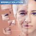 Face Lifting Tape - Sfuchin 2.5cm x 500cm Anti-Folding Multifunction Facial Tape - High Elastic Lip & Wrinkle Patches - 2 Rolls Pink for Instant Lift & Smooth Skin - Buy Online on GoSupps.com
