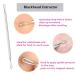 Blackhead Remover Tool Kit with Facial Cleansing Brush 3 Pieces Comedone Extractor Tool Blemish Whitehead Removal Acne Needle Pimple Spot Popper with Cleansing Blackhead Brush - Buy Online on GoSupps.com