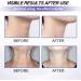 Neck Firming Cream Neck Skin Tightening Neck Cream for Sagging & Tighten Anti Ageing Cream for Women Anti Wrinkle Cream for Neck Neck Lift Tighten and Lift Neck Cream Tightening Moisturizer for Neck - Buy Online on GoSupps.com