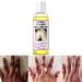 Peeling Oil Extra Strong Peeling Oil Yellow Peeling Oil for Dark Skin Exfoliating Peeling Solution for Body Hand Feet and Face All Skin Type (110ML/3.88 Fl Oz)