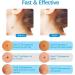 2-IN-1 Skin Tag Tool Kit for Men and Women Fast and Easy Micro Skin Tags Skin Tag Tool Kit Painless Skin Tag Kit for Small (2mm) to Medium (8.5mm) Skin Tags - Safe for Most Parts - Blue - Buy Online on GoSupps.com