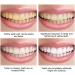 DUBUSH Yanjiayi Bamboo Charcoal Deep Cleaning Toothpaste Yanjiayi Activated Charcoal Whitening Toothpaste Deep Cleaning Whitening Toothpaste - Buy Online on GoSupps.com