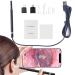 MDYNI Smart Visual Ear Cleaner Kit Ear Stick 5.5mm Endoscope Earpick Ear Cleaner Camera Otoscope with 6 LED Lights Ear Wax Earwax Removal Tool Black