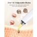 Ear Wax Removal Kit with HD Camera & 6 LED Lights for Safe Cleaning of Ear Canal | Compatible with iOS & Android Smartphones - Buy Online on GoSupps.com