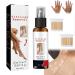 Alkyne Vitiligo Removal Relief Spray Vitiligoremoval Relief Spray Vitiligo Skin Repair Spray Vitiligo Treatment Spray Vitiligo Care Spray for Skin Care (1pc)