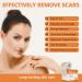 Medical Grade Silicone Scar Tape Roll - Postpartum Belly Band for Scars, Keloids, Burns & Thyroid - 1.6 x 60 | Effective Scars Removal Solution - Buy Online on GoSupps.com