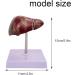 ARAZI Human Liver Pathology Model Visualization of Liver Lesions Clear Details Medical Teaching Props for Doctor-Patient Communication - Buy Online on GoSupps.com