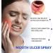 Mouth Ulcer Spray - 30ml Antibacterial Relief for Mouth Wounds & Soothing Care - Buy Online on GoSupps.com