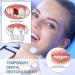 Premium Temporary Denture Set - DIY Heat Fit Beads for Quick Dental Restoration | Prosthesis & Repair Solutions - Buy Online on GoSupps.com