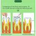 Specialty Gum Toothpaste for Root Canal Treatment | Nanohydroxyapatite Gum Repair | Relieves Pulpitis & Periodontitis Pain | Prevent Root Fracture | 3.52 Oz Spearmint - Buy Online on GoSupps.com