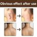 Waterproof Tattoo Cover Up Makeup Set for Dating, Party & Travel - Dark Color - Buy Online on GoSupps.com