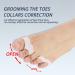 YUTTTPL 8 Pcs Toe Separators with 2 Loops Big Toe 2 Little Toe Corrector Toe Straighteners Hallux Valgus Correction Gel Toe Separator for Bunion Pain and Overlapping Toe Reduce Pain and Rubbing - Buy Online on GoSupps.com