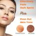 CAROT S Carotis Brightening Gel 30g - Fade Dark Spots on Face, Armpit, Body - Even Skin Tone with Carrot Oil & Alpha Arbutin - Buy Online on GoSupps.com