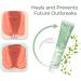 German Koltax Hemorrhoid Soothing Cream Natural Herbal Hemorrhoids Ointment Hemorrhoids Cream External Hemorrhoid Treatment Cream for All Ages (3 Pcs) - Buy Online on GoSupps.com