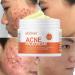 Acne Spot Treatment Cream for Acne 100g AHA BHA Lactic Acid & Zinc Scar Pimple Cream for Face Anti-Blemish Care  - Buy Online on GoSupps.com