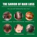 Organic Ginger Hair Regrowth Serum for Men and Women - Anti Hair Loss Treatment - Buy Online on GoSupps.com