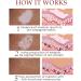 Kolmax Alkyne Psoriasis and Vitiligo Relief Spray - Reduces White Spots on Skin - 3PCS - Buy Online on GoSupps.com